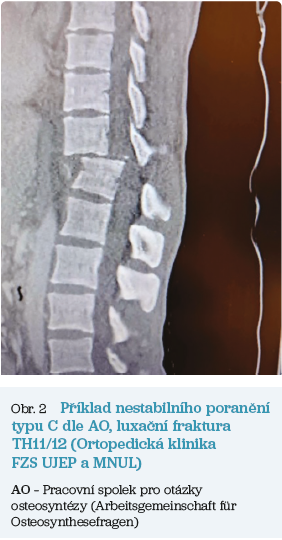 Obr. 2 Příklad nestabilního poranění