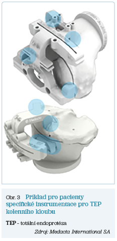 Obr. 3 Příklad pro pacienty specifické instrumentace pro TEP kolenního kloubu