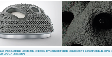 Obr. 7 Ukázka trabekulárního uspořádání konfekční revizní acetabulární komponenty a ultrastrukturální obraz