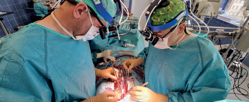 operace pětistého pacienta s chronickou tromboembolickou plicní hypertenzí